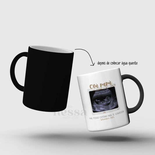 Caneca Mágica ECOGRAFIA